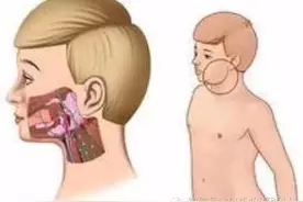 肌筋膜肌痛深入理解图片