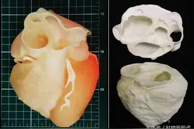 3D打印研究趋势系列之三---3D打印与医学的结合图片