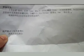 流褐色物一样有胎心胎芽 医生却当场这样对我说图片