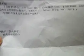 流褐色物一样有胎心胎芽 医生却当场这样对我说图片
