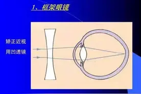 别愚蠢地认为，眼镜摘不下来，就干脆不佩戴....|名医专栏图片