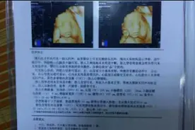 四维检查一次性通过 医生说宝宝腿短竟是因少了这图片