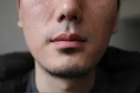 关于脸的脱毛图片