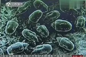 每晚和狗狗睡在一起，美女睫毛上有200多寄生虫！视频封面