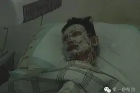 今日关注痛心！煤气泄漏爆炸 福州连江一家四口严重烧伤图片