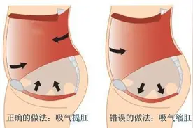 常提肛门对防治脱肛、痔疮等疾病非常有效图片