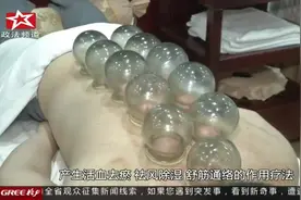 网友爆料：菲尔普斯也爱拔火罐视频封面