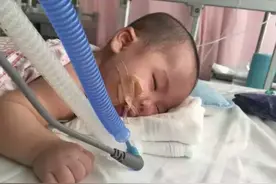惠州确诊首例庞贝氏症，被称为世界十大罕见病，患者才7个月大图片