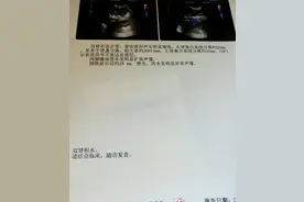 宝宝双肾肾盂分离20mm！作为妈妈的我心理很复杂!图片