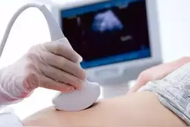 NT检查至关重要，孕妈一定要提前知道！图片