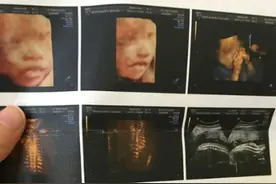 四维检查宝宝给力通过 居然还给了我们见面礼图片