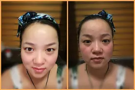 不用瘦脸针、不用大拉皮，四步骤打造紧致小V脸图片