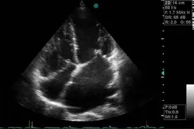 预防风心病比治疗风心病性价比更高！图片