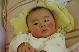 小孩湿疹是怎么引起的？儿童宝宝湿疹必备的护理常识！图片