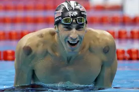 外媒：菲尔普斯无意间为拔罐"代言" 全世界都好奇图片