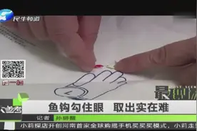 鱼钩勾住眼 取出实在难视频封面