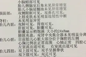孕24周四维顺利过关 医生偷偷跟我说是个小帅哥图片