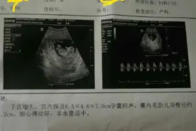 孕3月还是风风火火的女汉子 结果出现这个吓得去医院图片