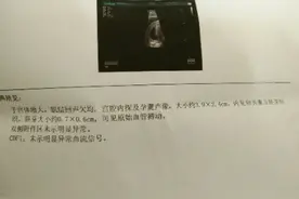 流褐色物出血也要淡定 孕早期这样保胎宝宝有胎心图片