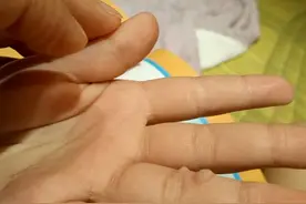 宝贝手上长了个奇怪的东西现在越来越大，现在老说疼~图片