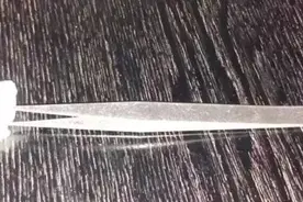 老外震惊了！“拔罐”成里约奥运会上的“新宠”！来自东方的神秘洪荒之力好处竟这么多！图片