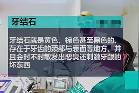 牙齿内有黄色污垢很难闻怎么办？教你一招，几分钟就能彻底清除视频封面