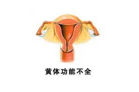 黄体功能不足会不孕吗？如何诊断？图片