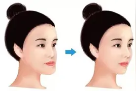 箍牙齿脸型真的会变吗？真相原来是这样的图片