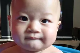 4岁女娃眼睛一大一小，检查发现长了个肿瘤图片