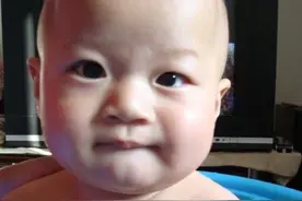 4岁女娃眼睛一大一小，检查发现长了个肿瘤图片