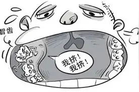 关于智齿，你先要知道这些图片