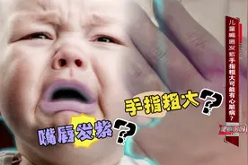 家长注意！孩子嘴唇发紫、手指粗大 可能患有心脏病！图片