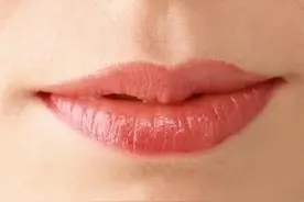 嘴唇干裂，越干越想舔，越舔越干躁结痂，这是咋哩？图片