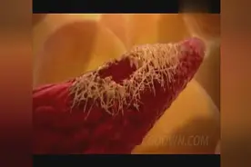 你知道血管破裂，会有怎么的变化？图片