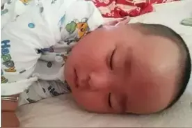 脱皮、褶皱红肿，新生儿常见皮肤问题，家庭护理怎么做？图片