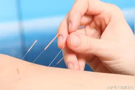中医的针灸治疗：癌症患者可以针灸吗？图片