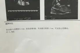 NT顺利通过，给胎停过，孕酮低，出血先兆流产宝妈们正能量！图片