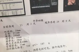 23周四维通过，确定是男宝，附怀男的一些特征，宝妈们都有吗图片