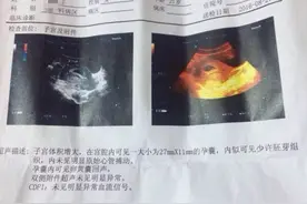 怀孕快两个月，检查B超还是没有胎心！该怎么办？图片