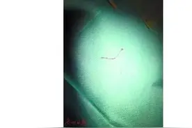 青蛙放嘴中捉“虫”  育儿“土方”真的有效吗？图片