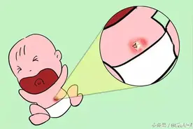 如何护理新生儿的肚脐图片