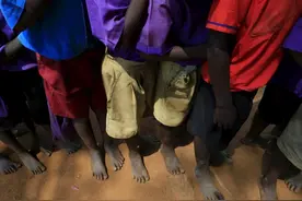 实拍非洲贫困山区患“沙蚤病”儿童的悲惨生活图片