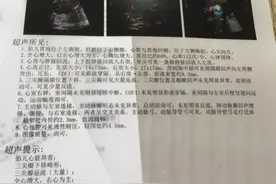 二胎6个月了，四维结果，让我心情十分难受图片