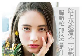我还能瞎说？脸上小疙瘩不一定都是脂肪粒，还会是这些图片