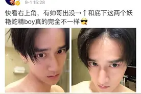 蒋劲夫的逆天发际线+锥子脸，现在男星也流行整成蛇精脸了？图片