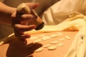 大美坐诊：大姨妈推迟、35岁经期提前、阳虚、 脾虚、肾阳等.图片