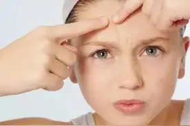 1分钟带你全方位了解祛痘攻略！（内含祛痘单品推荐）图片