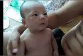 刚出的宝宝 ，不管男女乳房肿胀有奶核，该不该给他挤？图片
