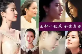 鼻翼宽缩小就行 鼻头大必须做鼻综合图片