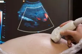 闺蜜孕36周，吸了3天氧！孕妈注意，3大症状揭示胎儿正缺氧！图片